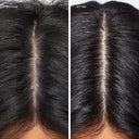 Best Shampoo for an Itchy Scalp: What Actually Helps
